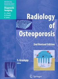 صورة الغلاف: Radiology of Osteoporosis 2nd edition 9783540258889