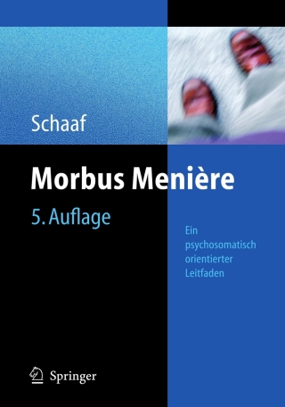 Cover image: Morbus Menière 5th edition 9783540369608