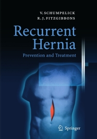 Titelbild: Recurrent Hernia 1st edition 9783540375456