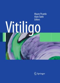 صورة الغلاف: Vitiligo 1st edition 9783540693604