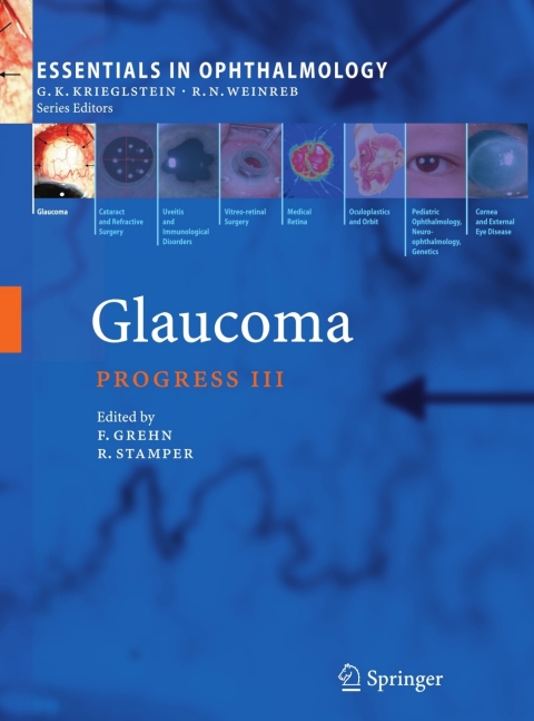 Glaucoma, 1st Edition - FULL INSTANT DOWNLOAD | PDF DOCX EPUB