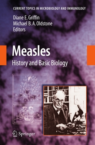 Immagine di copertina: Measles 1st edition 9783540705222
