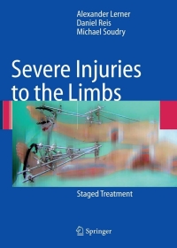 Cover image: Severe Injuries to the Limbs 9783540698920