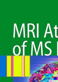 Cover image: MRI Atlas of MS Lesions 9783540713715