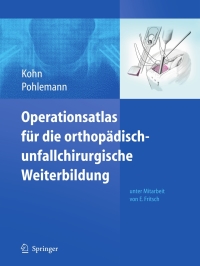 Cover image: Operationsatlas für die orthopädisch-unfallchirurgische Weiterbildung 9783540725138