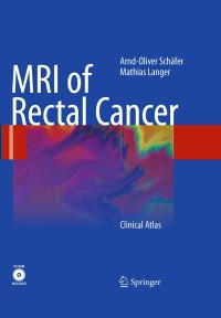 表紙画像: MRI of Rectal Cancer 9783540728320