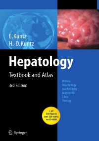 صورة الغلاف: Hepatology 3rd edition 9783540768388