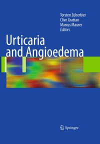 表紙画像: Urticaria and Angioedema 1st edition 9783540790471