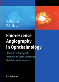 صورة الغلاف: Fluorescence Angiography in Ophthalmology 9783540783596