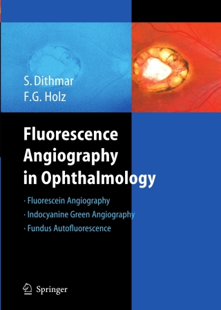 Imagen de portada: Fluorescence Angiography in Ophthalmology 9783540783596