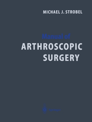 Cover image: Manual of Arthroscopic Surgery 9783540857372