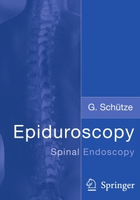 Cover image: Epiduroscopy 9783540875444