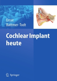 Cover image: Cochlear Implant heute 1st edition 9783540882350