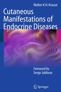 Imagen de portada: Cutaneous Manifestations of Endocrine Diseases 9783540883661