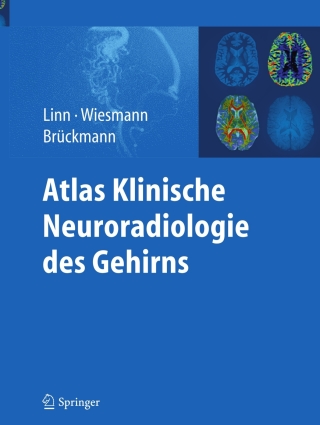 Imagen de portada: Atlas Klinische Neuroradiologie des Gehirns 1st edition 9783540895688