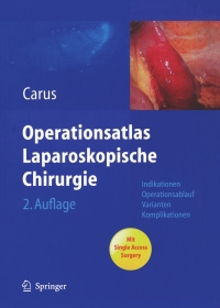 Omslagafbeelding: Operationsatlas Laparoskopische Chirurgie 2nd edition 9783642017063