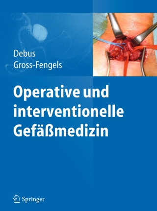 Cover image: Operative und interventionelle Gefäßmedizin 9783642017087