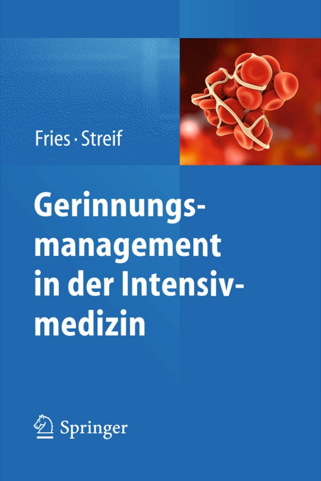 Gerinnungsmanagement in der Intensivmedizin