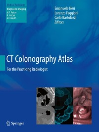 表紙画像: CT Colonography Atlas 9783642111488