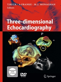 Cover image: Three-dimensional Echocardiography 1st edition 9783642111785
