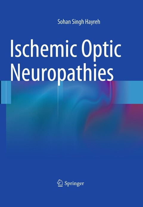 Ischemic Optic Neuropathies - FULL INSTANT DOWNLOAD | PDF DOCX EPUB
