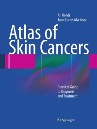 صورة الغلاف: Atlas of Skin Cancers 9783642133985