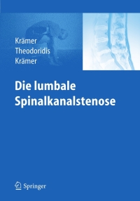 Imagen de portada: Die lumbale Spinalkanalstenose 9783642138423