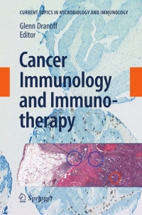 Immagine di copertina: Cancer Immunology and Immunotherapy 9783642141355