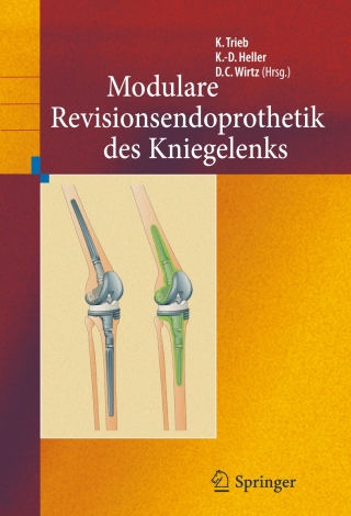 Cover image: Revisionsendoprothetik des Kniegelenks 1st edition 9783642161223