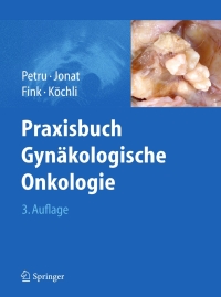 Cover image: Praxisbuch Gynäkologische Onkologie 3rd edition 9783642170751