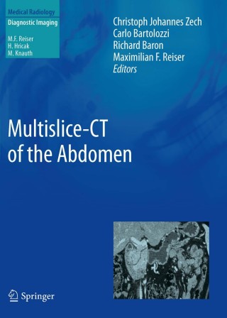 Cover image: Multislice-CT of the Abdomen 1st edition 9783642178627