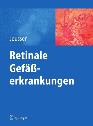 Cover image: Retinale Gefäßerkrankungen 1st edition 9783642180200