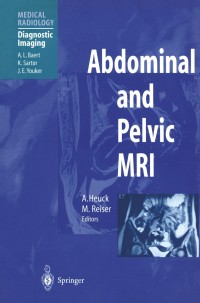 Cover image: Abdominal and Pelvic MRI 1st edition 9783540614500