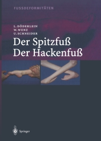 Cover image: Fussdeformitäten 9783540674412