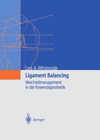 Imagen de portada: Ligament Balancing 9783642622472