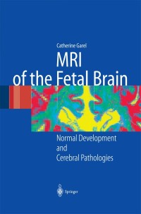 Cover image: MRI of the Fetal Brain 9783540407478