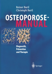 Cover image: Osteoporose-Manual 9783540208921