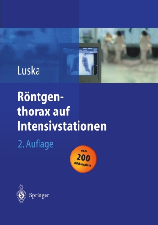 Cover image: Röntgenthorax auf Intensivstationen 2nd edition 9783540407799