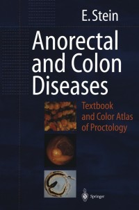 Titelbild: Anorectal and Colon Diseases 9783642623905