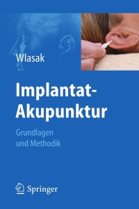 表紙画像: Implantat-Akupunktur 9783642200250