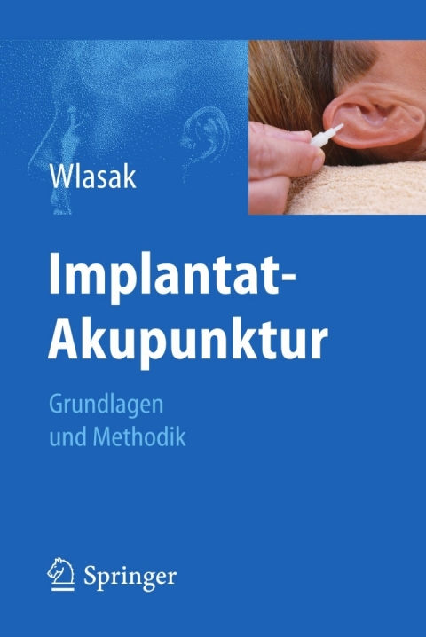 Implantat-Akupunktur: Grundlagen und Methodik - FULL INSTANT DOWNLOAD | PDF DOCX EPUB