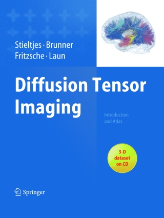 Cover image: Diffusion Tensor Imaging 9783642204555
