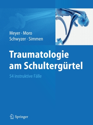 Titelbild: Traumatologie am Schultergürtel 9783642218170