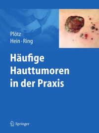 صورة الغلاف: Häufige Hauttumoren in der Praxis 9783642247019