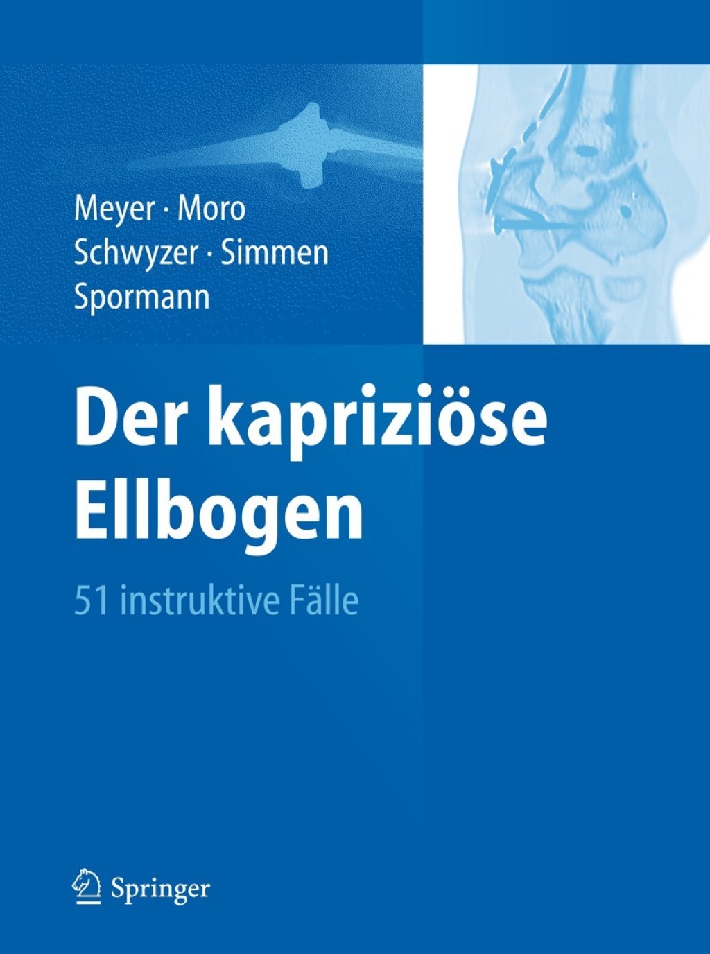 Der kapriziöse Ellbogen 51 instruktive Fälle 1st Edition