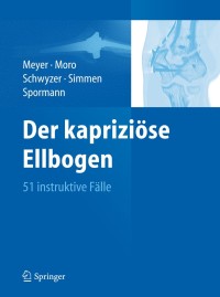 Titelbild: Der kapriziöse Ellbogen 1st edition 9783642258800