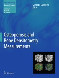 Titelbild: Osteoporosis and Bone Densitometry Measurements 9783642278839