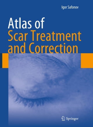 表紙画像: Atlas of Scar Treatment and Correction 9783642291951