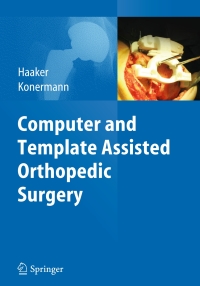 Cover image: Computer and Template Assisted Orthopedic Surgery 9783642297274
