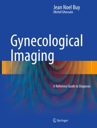 Titelbild: Gynecological Imaging 9783642310119